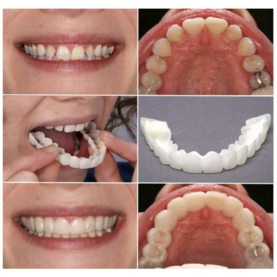 Dentsmile Temporäre Zahnverblendungen, Unisex, 8 Sets - Bild 3