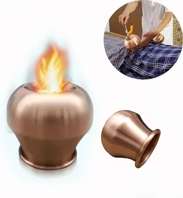 Yuwell Schröpfergläser Kupfer, Unisex - Bild 1