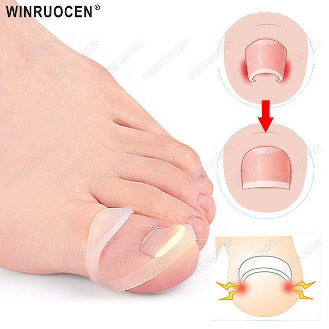 WINRUOCEN Nagelkorrektur Klammer für Füße, Silikon - Bild 1