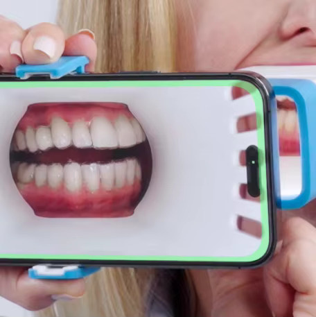 NICEDEN Oral mobiles Foto-Positionierungsgerät für die zahnmedizinische und kieferorthopädische Aufzeichnung - Bild 4