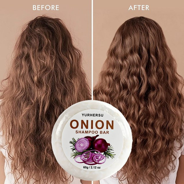 YURHERSU Zwiebel-Shampoo-Bar, Vegane feste Shampoo-Seife gegen Schuppen und trockenes Haar - Bild 1