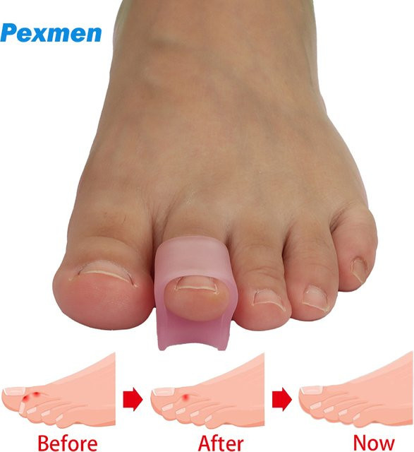Pexmen Hammerzehen-Korrektor, 2 Stück, Gel-Zehenglätter, Unisex - Bild 1