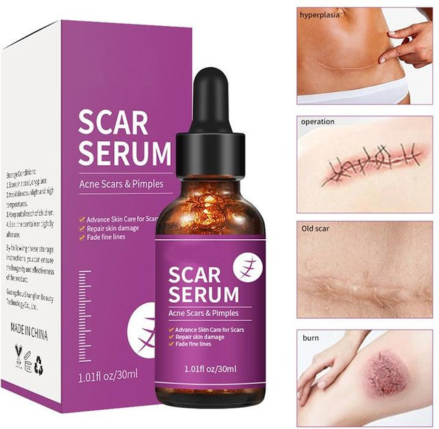 HYQING Narbenreparatur-Essenz Serum, 30 ml, mit Aloe Vera, Niacinamid, Hyaluronsäure - Bild 1