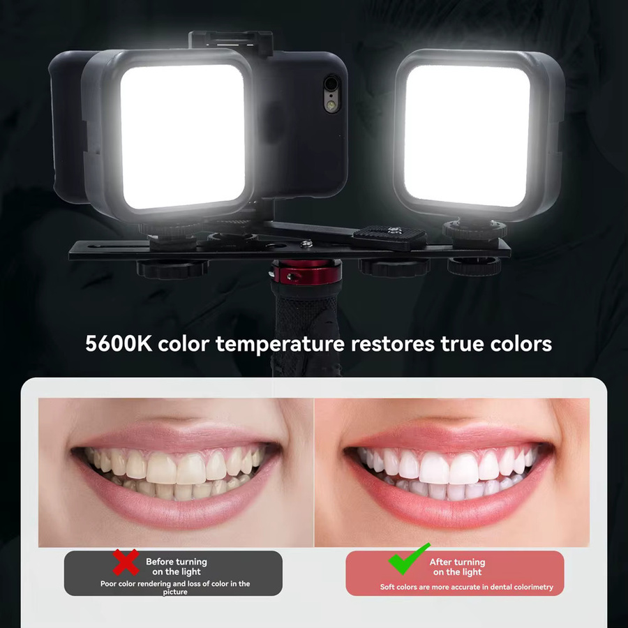 Dentztelefon Fotolicht in Schwarz: Professionelle Beleuchtung und Zahnärzteskamera mit Weitwinkelobjektiv für mobile Videos und Fotos - Bild 5