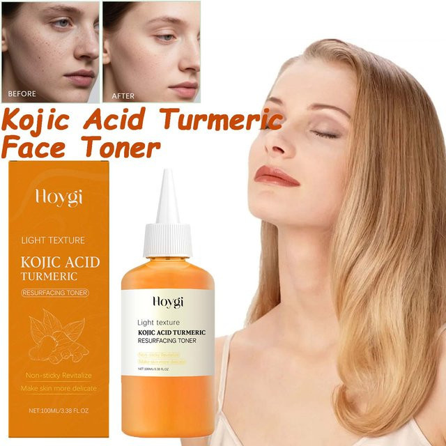 Hoygi Kojisäure-Kurkuma-Toner, Gesichtspflege für fettige Haut, 100 ml - Bild 1