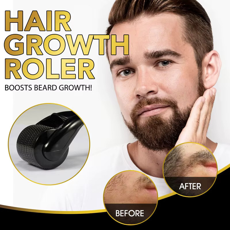 miqmi Derma Roller, 540 Nadeln, für Gesicht, Körper und Haare, Unisex - Bild 4