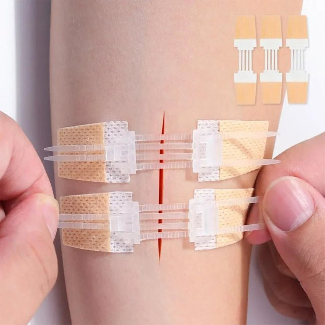 Seap-Free Klebeband für Erwachsene, schmerzloses Wundnahtband mit Reißverschluss, beige - Bild 1