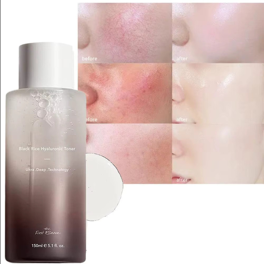 Haruharu Wonder Black Rice Toner mit Hyaluronsäure, Unisex - Bild 2