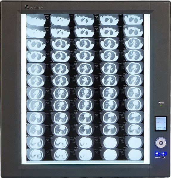 Mplent LED Negatoskop mit Einzelpanel für medizinische Röntgenbild-Ansicht in Schwarz und Weiß - Bild 1