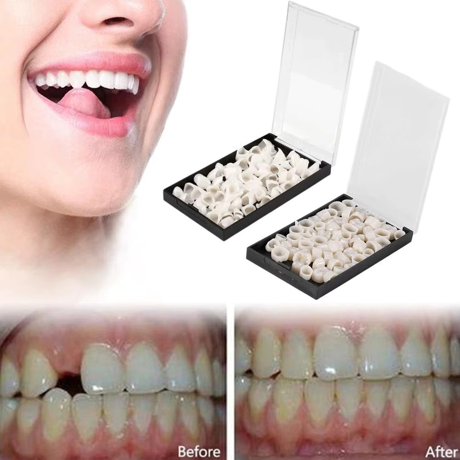 Oralhoe Temporäre Zahnkronen für Vorder- und Hinterzähne - Bild 3