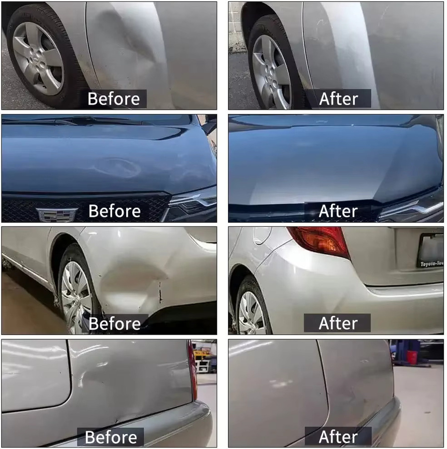 Super PDR Professionelles Beulenreparatur Set für lackfreie Autohagelschaden Reparatur mit Saugnapf und Beulenzieher - Bild 4