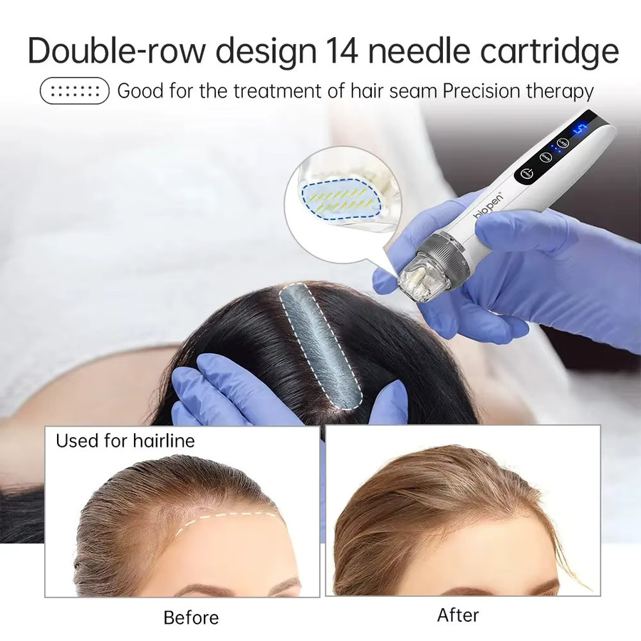 Dr. Pen Microneedling-Kartuschen mit Titan-Nadeln, 10 Stück, 0,25 mm - Bild 2
