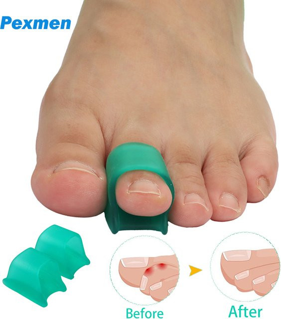 Pexmen Zehenglätter Gel, 2/4 Stück, Unisex - Bild 1