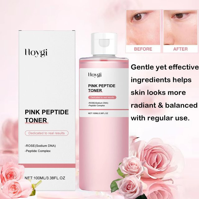Hoygi Rose Essence Toner mit Peptide, 100 ml, Unisex - Bild 1