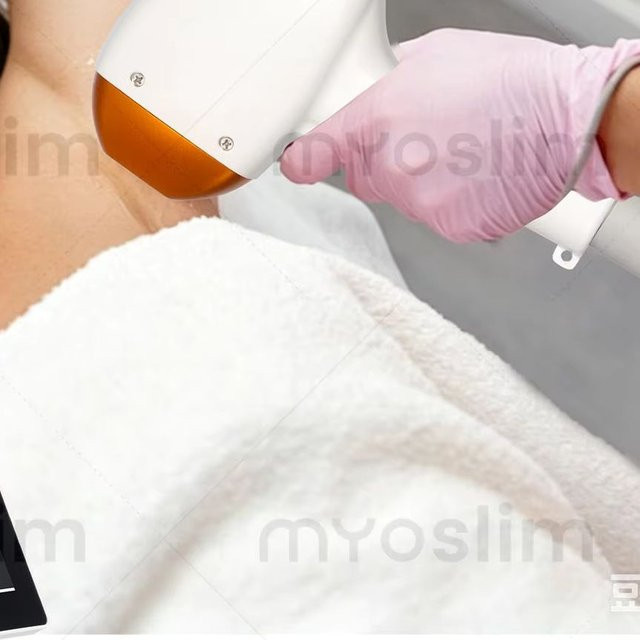 MYOSLIM Haarentfernungsgerät, 10 Bars, 4 Wellenlängen, Weiß, Unisex - Bild 1