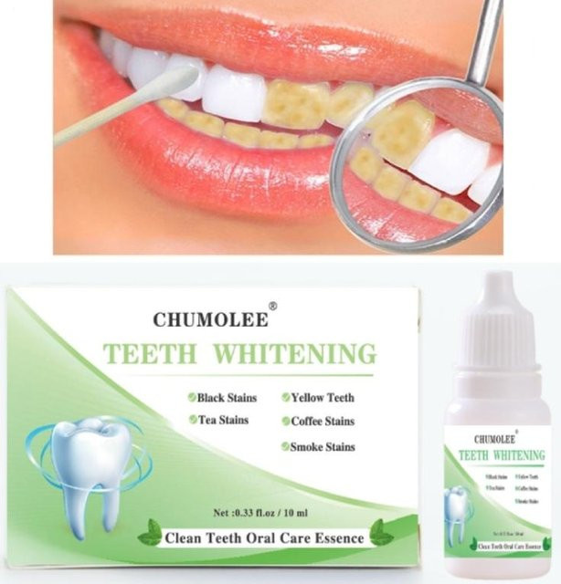 CHUMOLEE Zahnweiß- und Reinigungsflüssigkeit, 10 ml - Bild 1