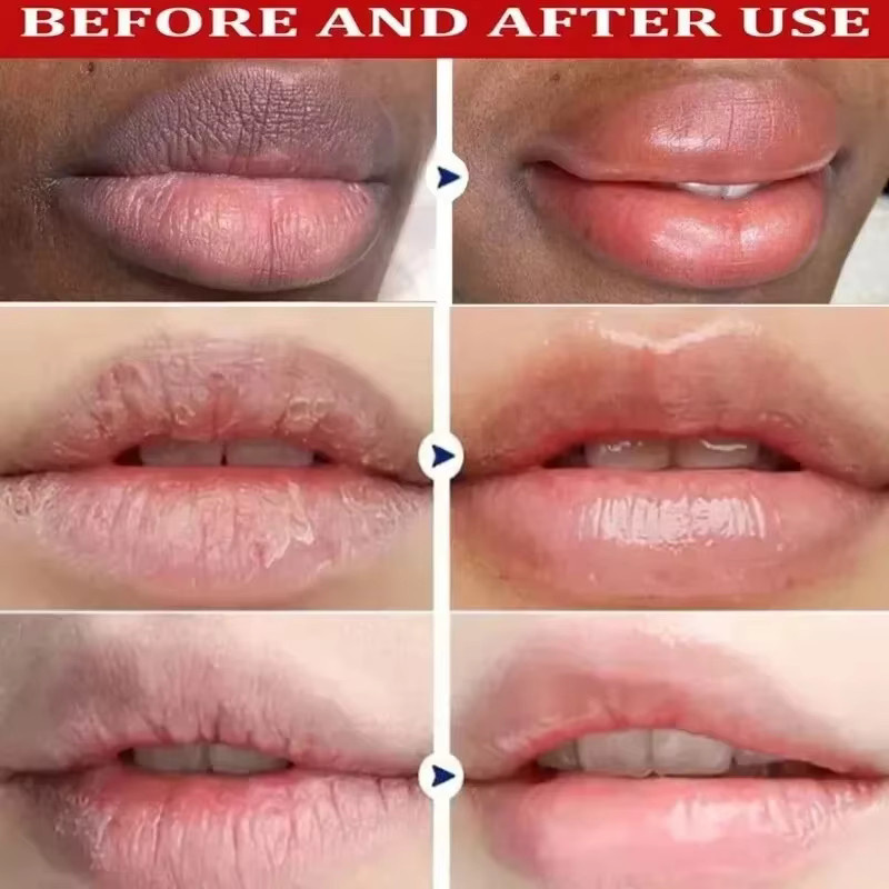 PWYUMAN Lippen-Serum - Bild 2