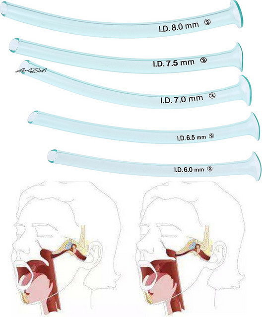 Einweg-Gesundheitspflege-Set für nasopharyngealen Airway Nasal Pharyngeal Channel - Bild 1