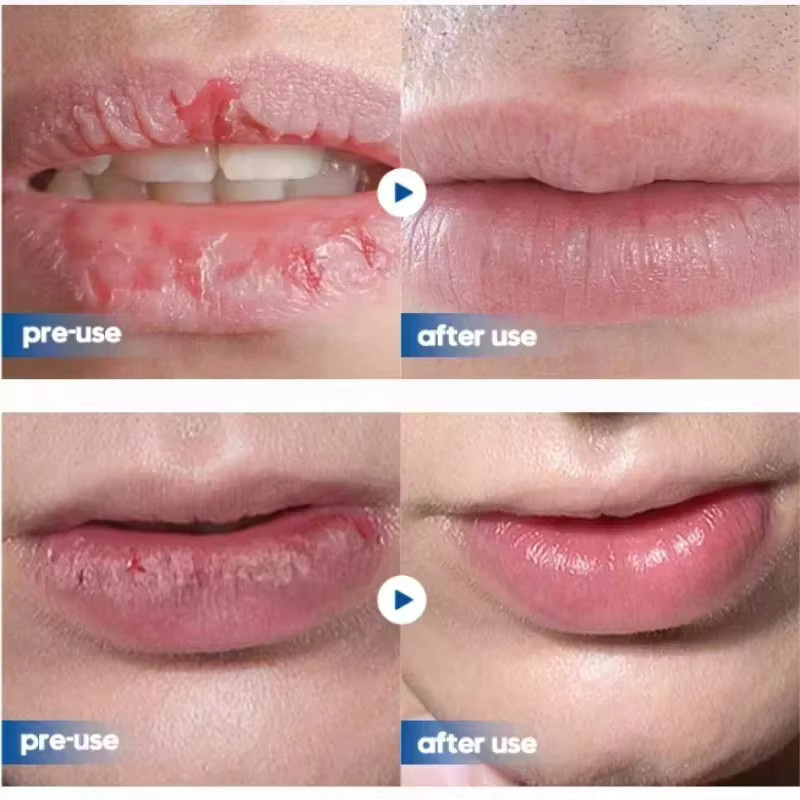 SADOER Lippenbalsam, Herren - Bild 2