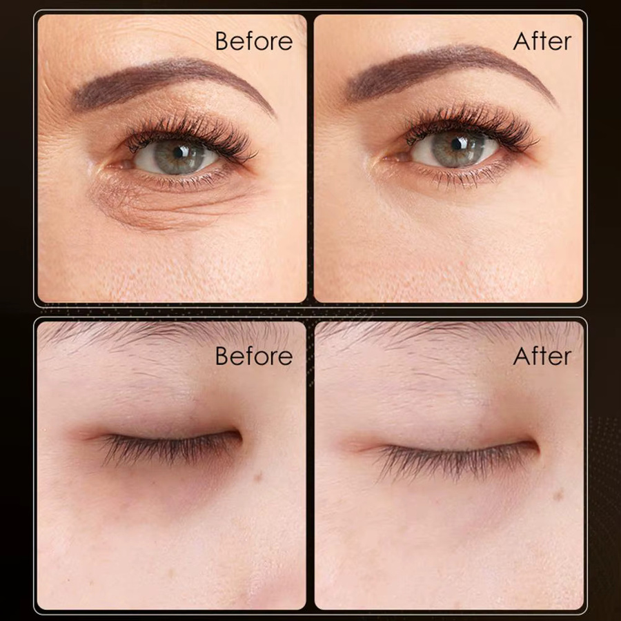 eelhoe Collagen Gold Feuchtigkeitscreme mit Kollagen, Augen, Reife Haut - Bild 4