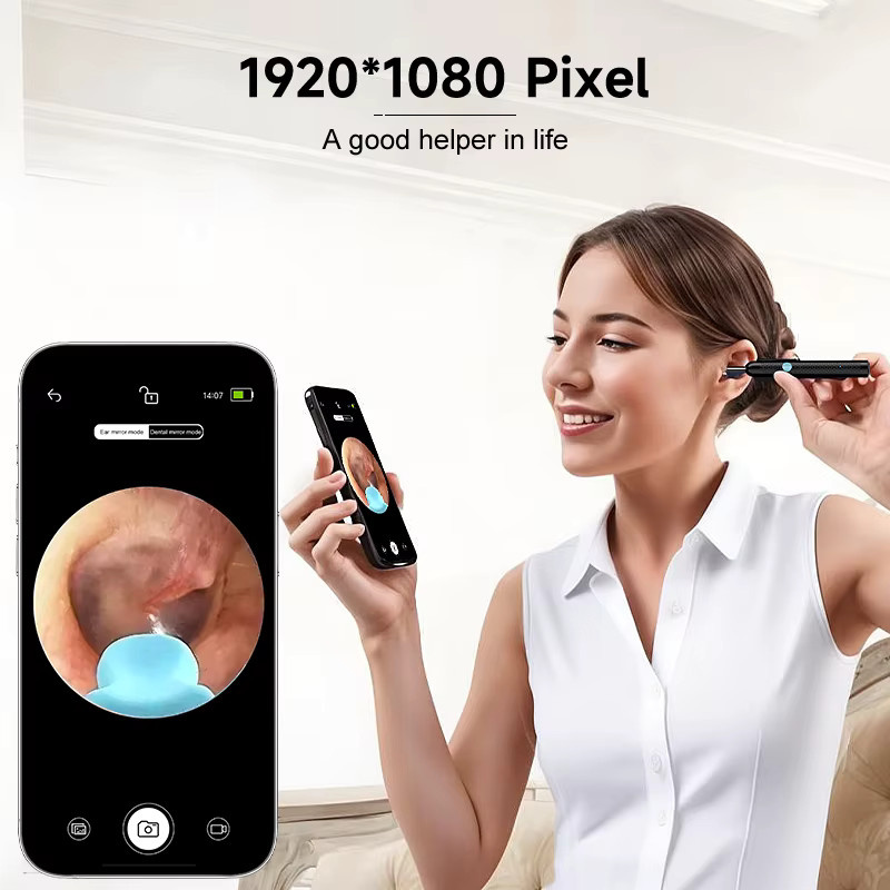 VISHRT Digitales Otoskop mit Kamera und Ohrenlöffel als Video-Endoskop zur Ohrenschmalz-Entfernung für iPhone und Android-Smartphones, Weiß - Bild 2