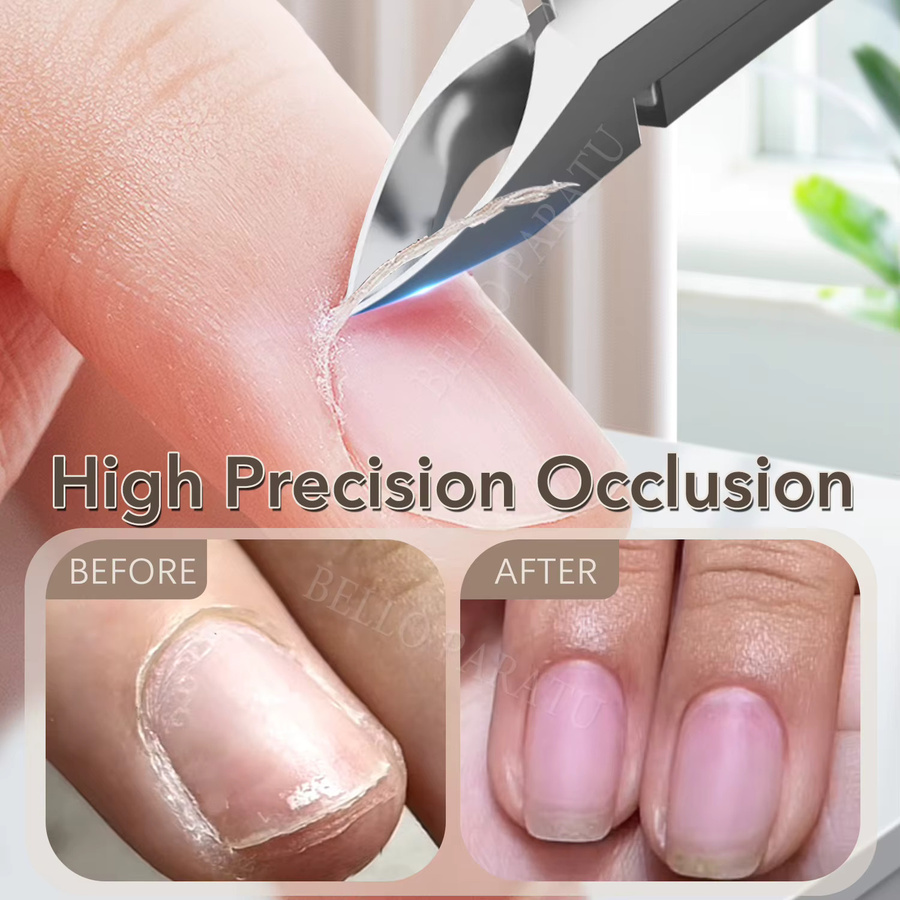 Häutchen Trimmer, professionelle Nageltier-Zange aus Edelstahl - Bild 3