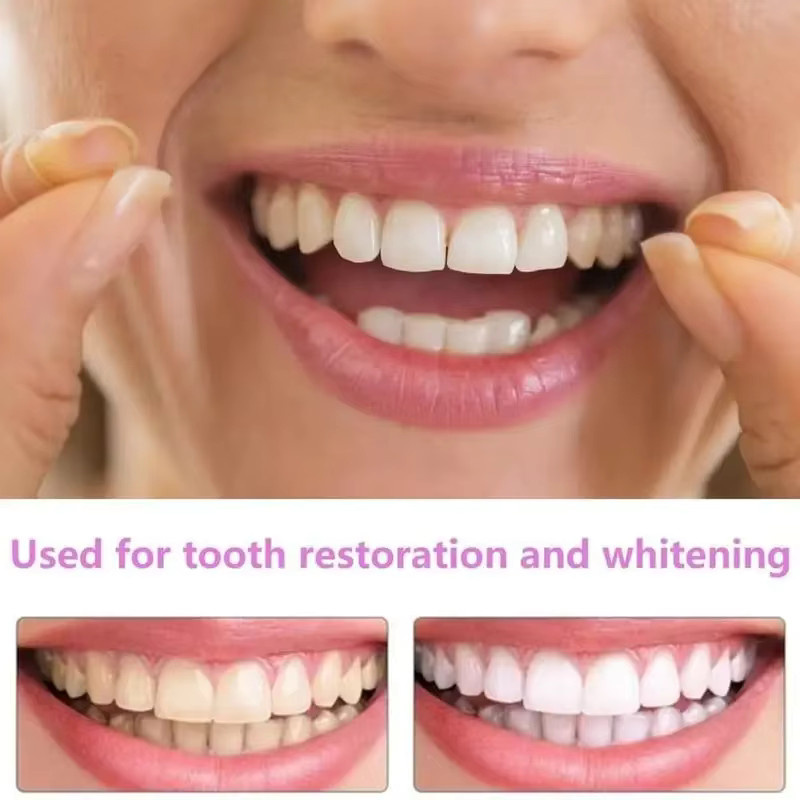 Instant Smile Silikon-Veneers, aufsteckbare obere Zahnabdeckung, Erwachsene - Bild 2