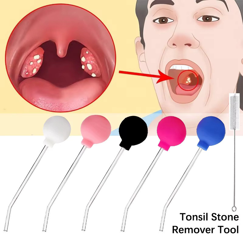 YOVIP Manueller Tonsil Stone Entferner, Mundreinigung, Unisex - Bild 2