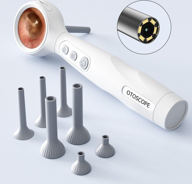 ZYPUSON Otoskop mit HD-Kamera, 4-facher Vergrößerung, 6-LED-Licht, für Ohr, Nase und Haut - Bild 1