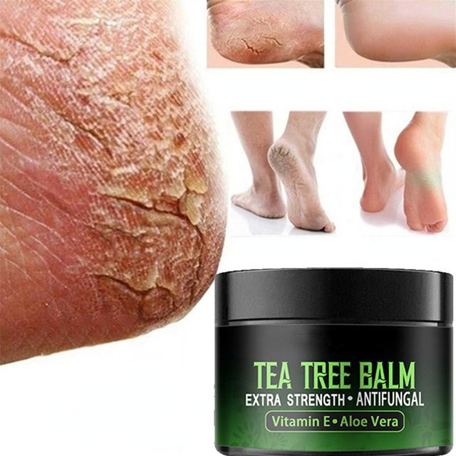 Fuß- und Handcreme mit Hyaluronsäure und Kollagen, 30 g - Bild 1