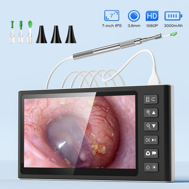 ZYPUSON Digitales Otoskop mit 7-Zoll-Bildschirm, Unisex - Bild 1