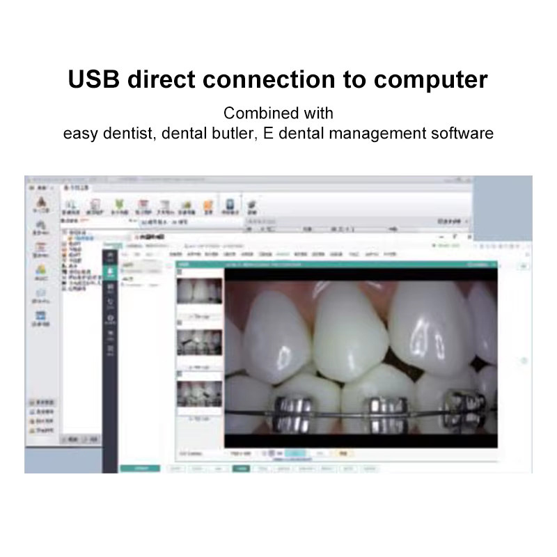 VVDental USB Intraorale Kamera 4K HD Smart Focus mit hoher Auflösung für orale Untersuchungen in Weiß - Bild 2