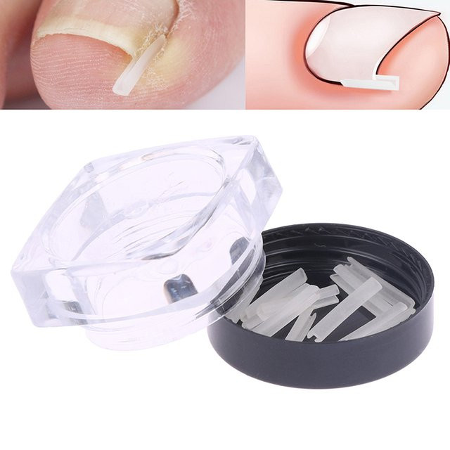 HNKMP Nagelkorrektur-Aufkleber für eingewachsene Zehennägel, 10 Stück, Unisex - Bild 1