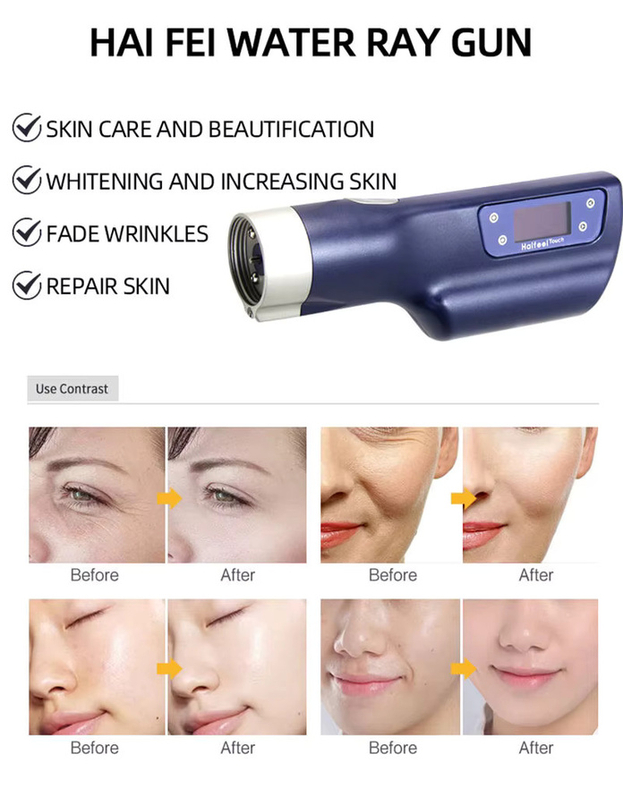 Epilpro Mesogun Injektor mit Hyaluronsäure, Unisex - Bild 3