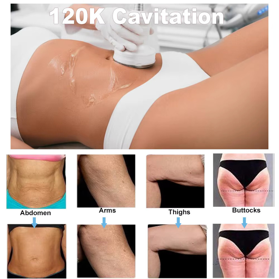 FAZJEUNE 6-in-1 Kavitations-Vakuumtherapie RF-Körperformungsgerät, Unisex - Bild 2