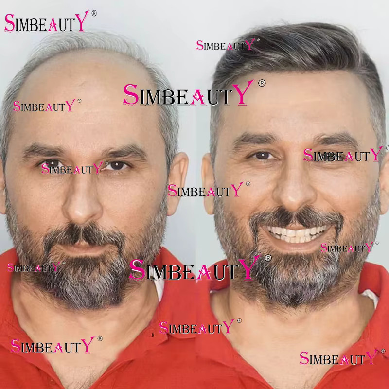 simbeauty Micro-Skin Toupet, indisches Echthaar, Weißgrau - Bild 2