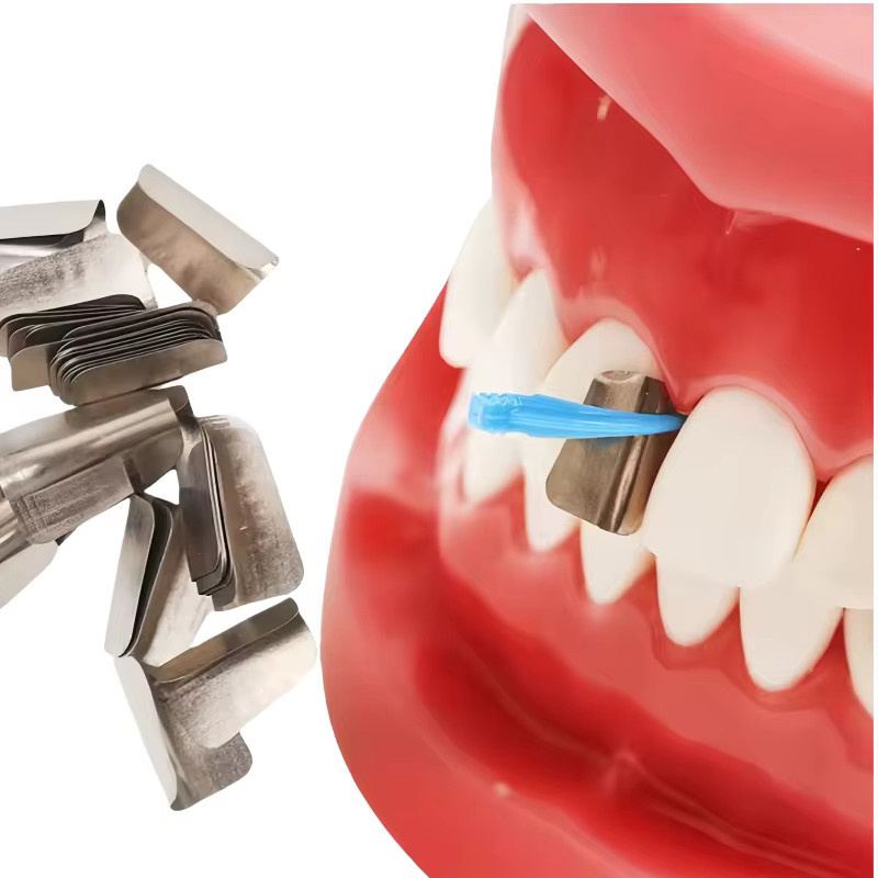 LGFU Dental Vordere Zähne Bilden Tabletten Keile Set, 200 Stück - Bild 3