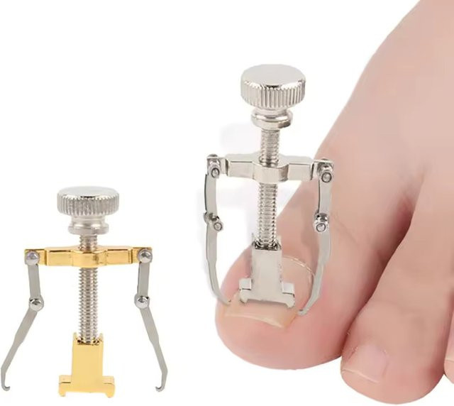 Breathleshades Zehennagel Corrector, Pediküre Werkzeug zur Nagelpflege - Bild 1