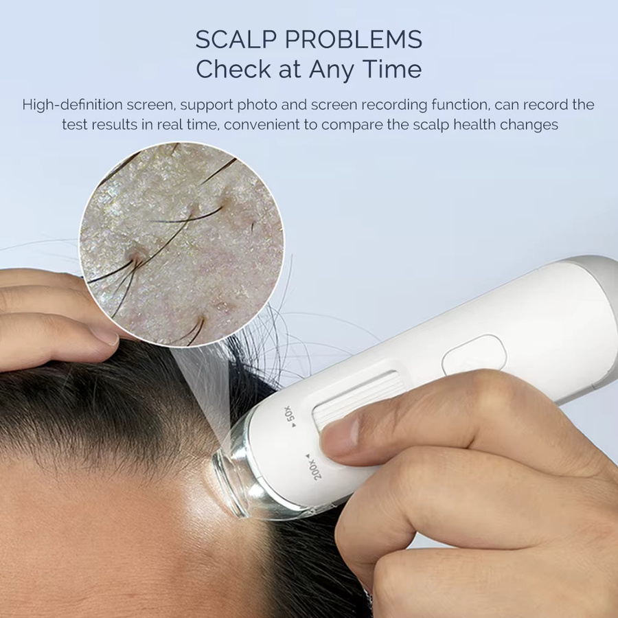 foreverlily Visueller Dermatoskop Kopfhaut und Gesicht Analysator, 50X/200X - Bild 3