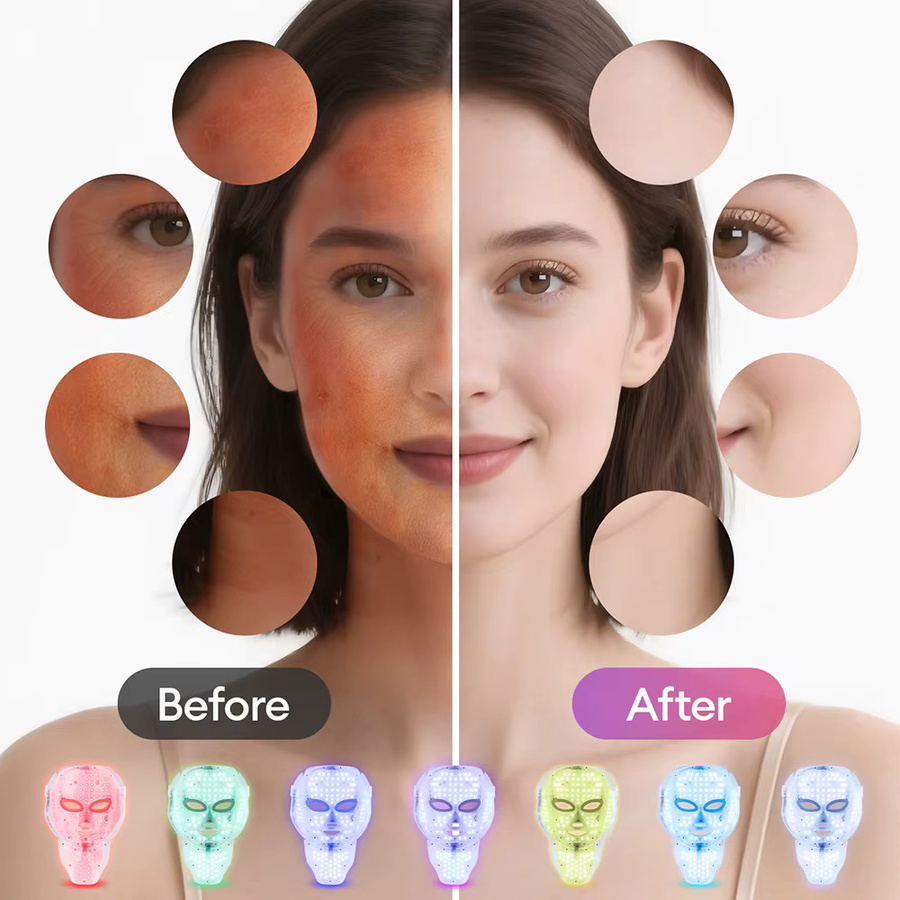 foreverlily LED-Gesichts-Hals-Maske, 7-Farben-Licht, Unisex, Reife Haut - Bild 4