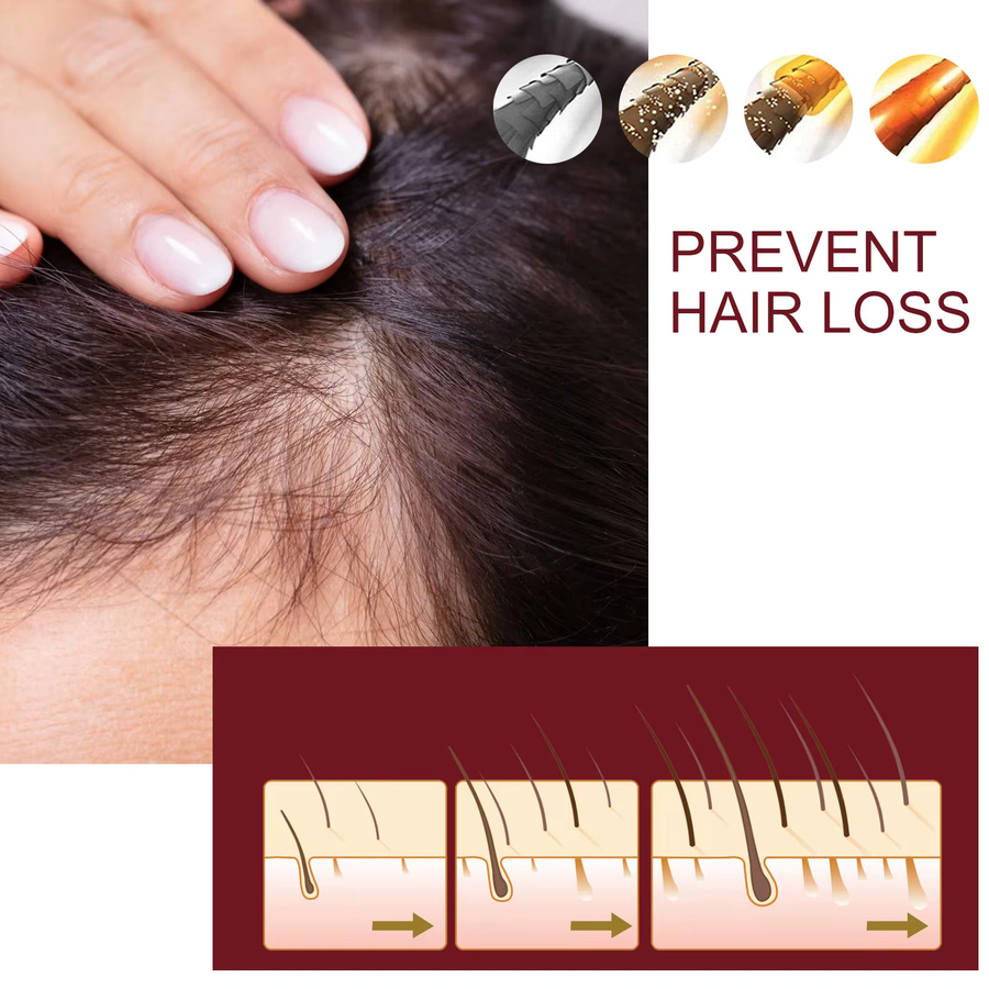 OUHOE Haarwiederherstellungsserum, 50 ml, für trockenes und strapaziertes Haar - Bild 6