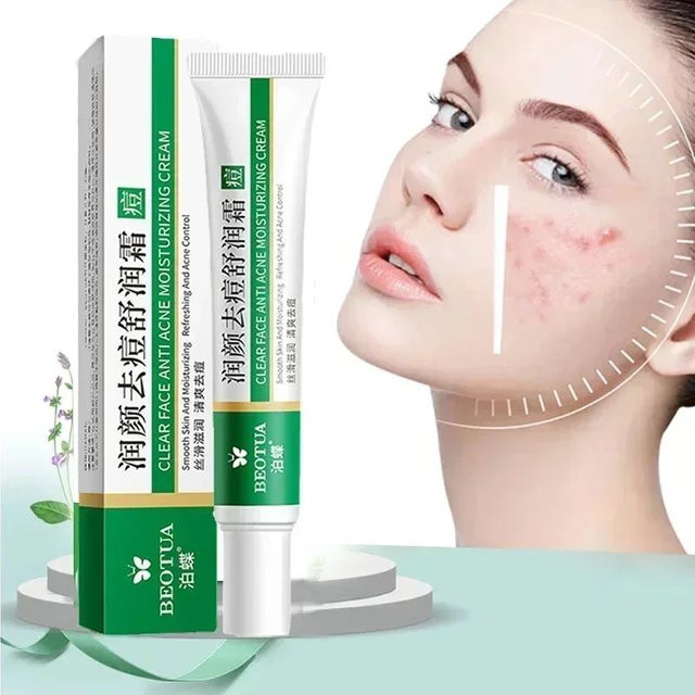 LANBENA Akne Behandlung Creme, Gesicht, Unisex - Bild 1