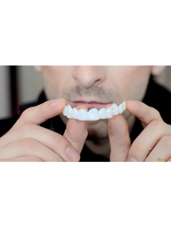 Pop Dental Snap Smile Zahnprothesen für den Oberen Kiefer, Flexible Veneers - Bild 7