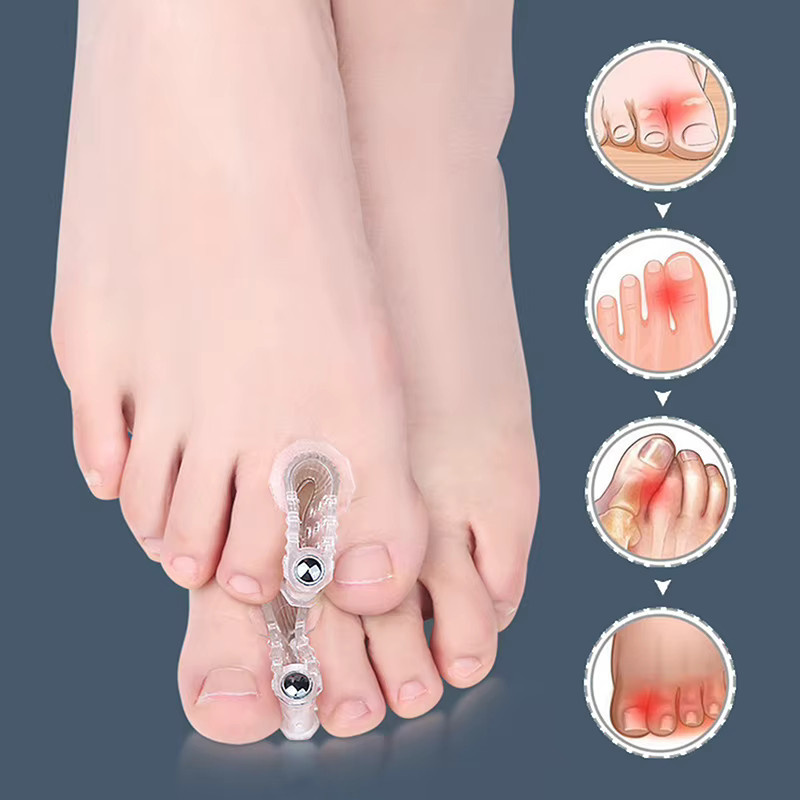Jiauting Zehenspreizer Bunion Hallux Valgus Corrector, Unisex - Bild 3