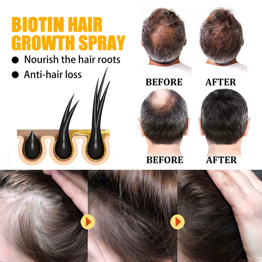 EELHOE Biotin Haarspray, 30 ml, Unisex - Bild 4