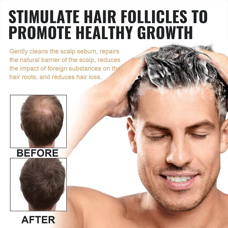 Eelhoe Natural Root Activator Shampoo, Haarpflege - Bild 5