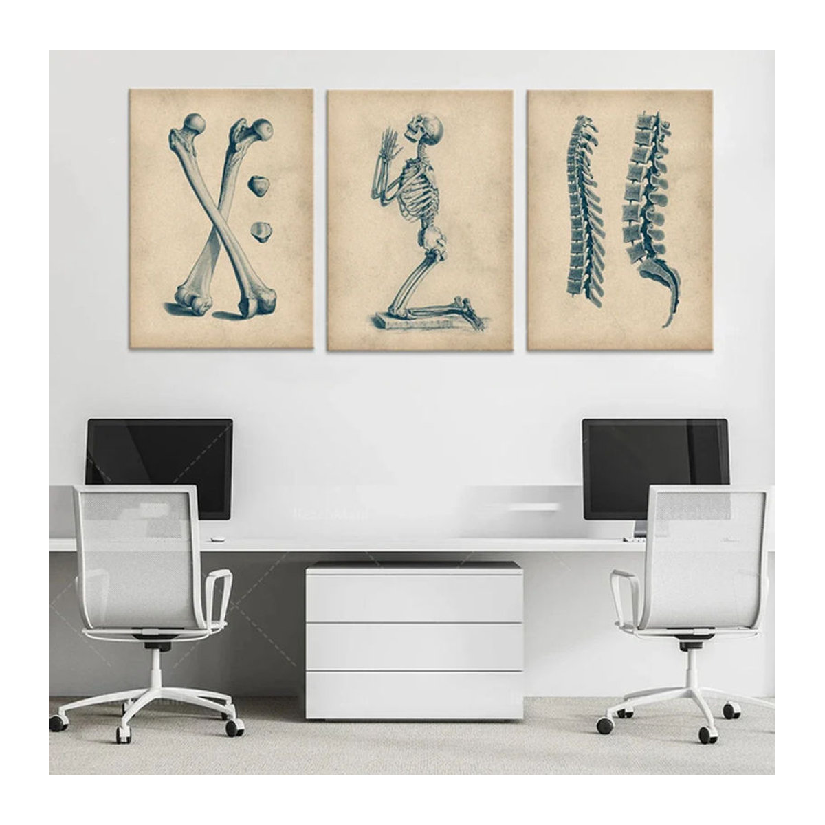 Potdemiel Knochenanatomie-Poster im Vintage-Stil, Beige, Rechteckiges Papier-Poster für die Wanddekoration - Bild 1