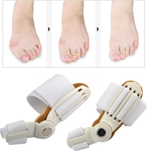 CAMMUO Hallux Valgus Korrektor, Fußpflege Werkzeug - Bild 1