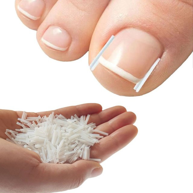 Simpleyibay Korrekturwerkzeug für eingewachsene Zehennägel, Unisex - Bild 1