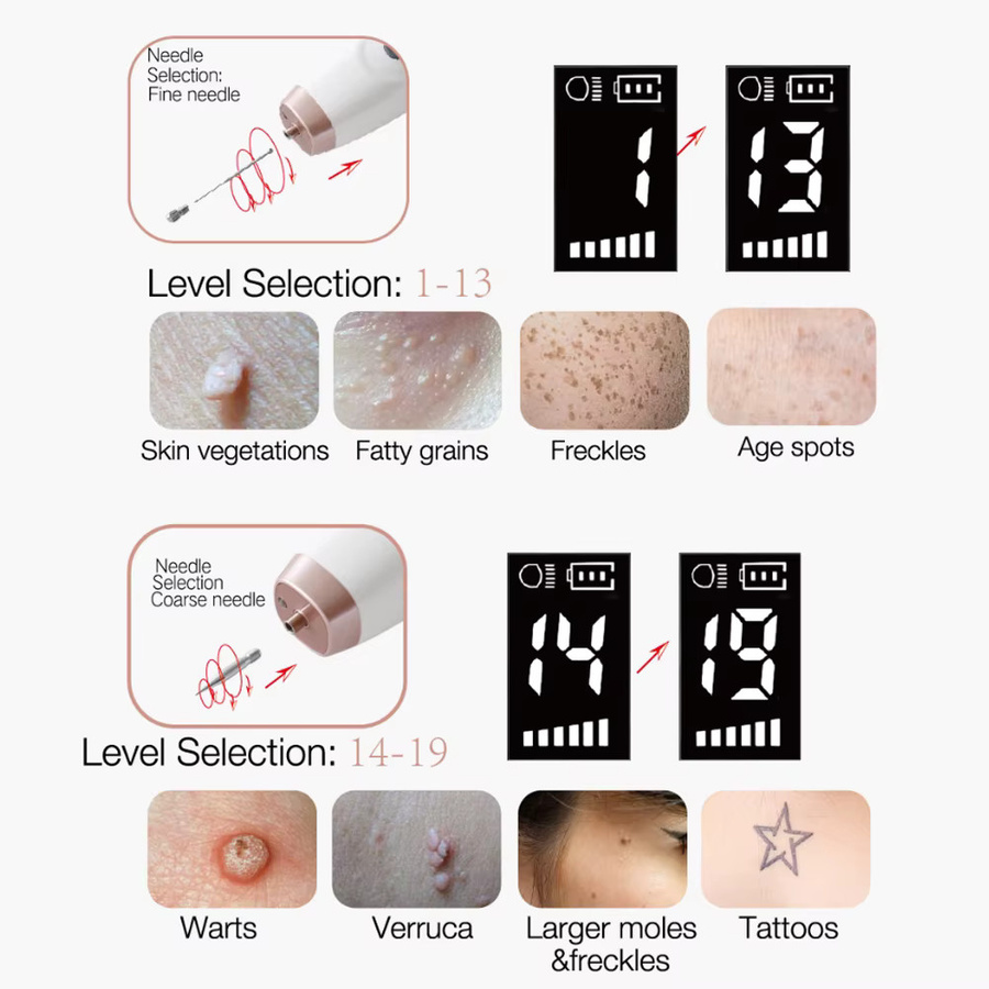 SANPKON Plasma Pen zur Tattooentfernung, Unisex, für das Gesicht - Bild 2